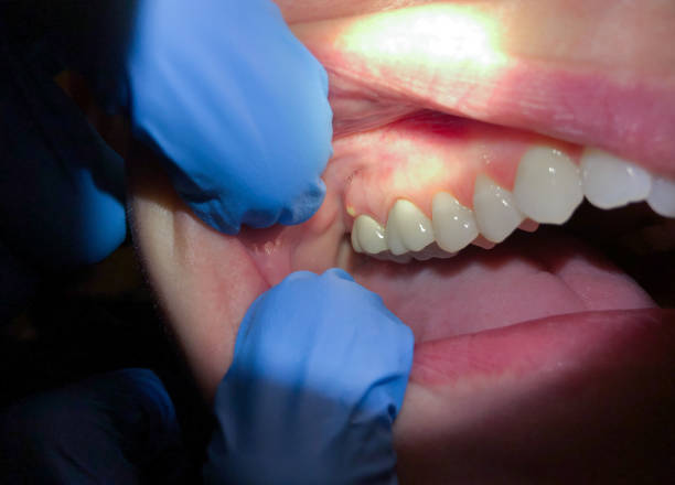 Best Same-Day Emergency Dental Services in Lakewood Park, TN